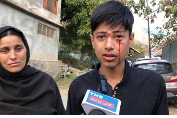 Student Allegedly  beaten ruthlessly by teacher at Darsgah in Ganderbal