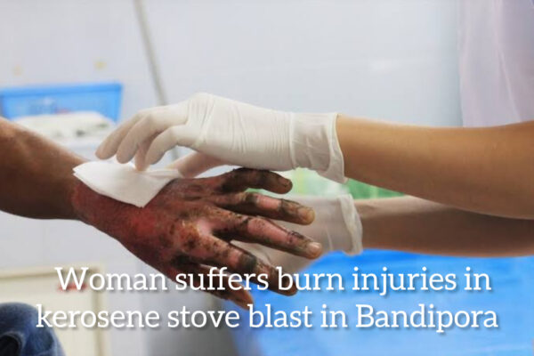 Woman suffers burn injuries in kerosene stove blast in Bandipora