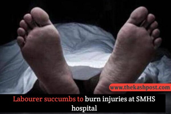 Labourer succumbs to burn injuries at SMHS hospital