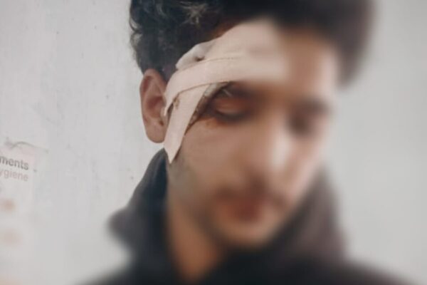 Youth injured after being attacked in Ganderbal